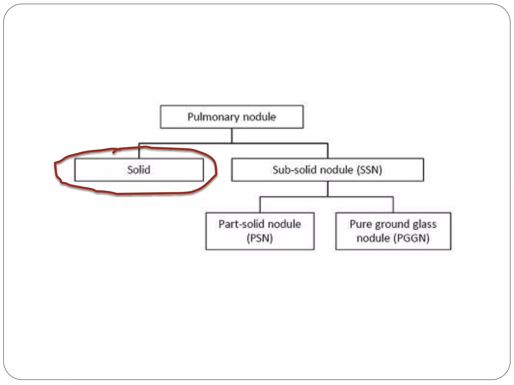British Thoracic Society Guidelines on Lung nodules #Vama2015 | PPTX