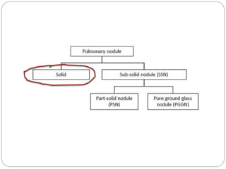British Thoracic Society Guidelines on Lung nodules #Vama2015 | PPTX