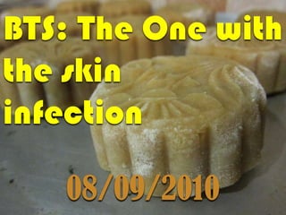 BTS: The One with the skin  infection 08/09/2010 