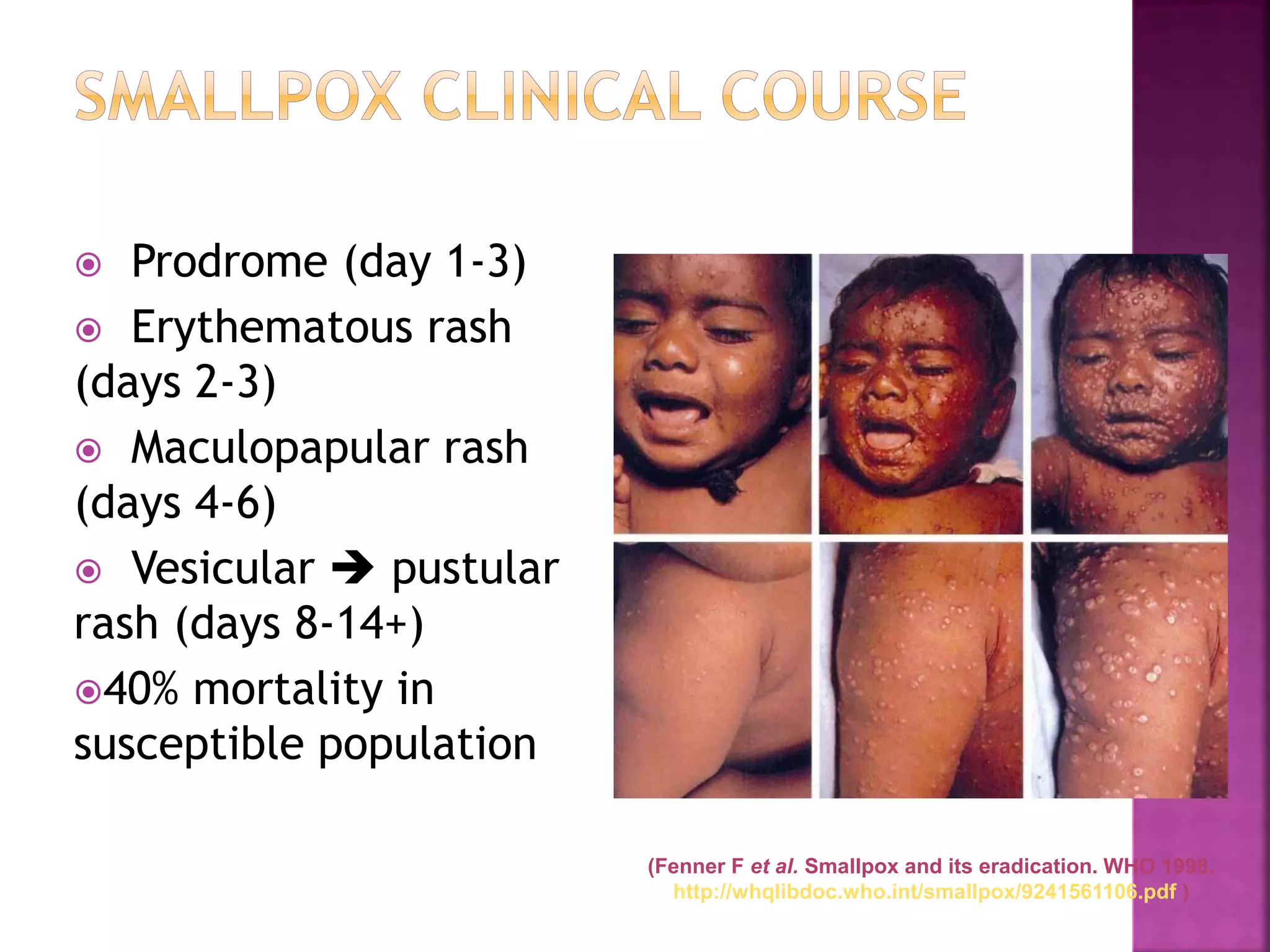  Prodrome (day 1-3)
 Erythematous rash
(days 2-3)
 Maculopapular rash
(days 4-6)
 Vesicular  pustular
rash (days 8-14+)
40% mortality in
susceptible population
(Fenner F et al. Smallpox and its eradication. WHO 1998.
http://whqlibdoc.who.int/smallpox/9241561106.pdf )
 