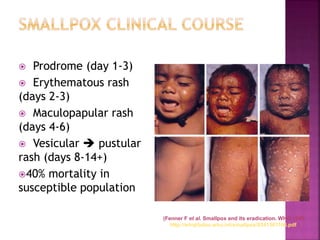  Prodrome (day 1-3)
 Erythematous rash
(days 2-3)
 Maculopapular rash
(days 4-6)
 Vesicular  pustular
rash (days 8-14+)
40% mortality in
susceptible population
(Fenner F et al. Smallpox and its eradication. WHO 1998.
http://whqlibdoc.who.int/smallpox/9241561106.pdf )
 