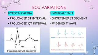 ECG VARIATIONS
HYPOCALCAEMIA
• PROLONGED ST INTERVAL
• PROLONGED QT INTERVAL
HYPERCALCEMIA
• SHORTENED ST SEGMENT
• WIDENED T WAVE
 