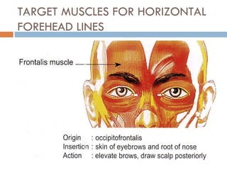 Forehead Target Botox injection ( anti aging and aesthetic medicine | PPT