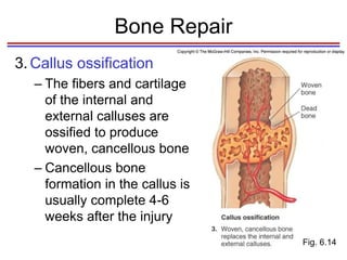 Initial Callus Formation 6_histo_bone.ppt