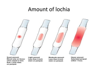 Amount of lochia
 