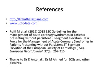 References
• http://lifeinthefastlane.com
• www.uptodate.com
• Roffi M et al. (2016) 2015 ESC Guidelines for the
management of acute coronary syndromes in patients
presenting without persistent ST-segment elevation: Task
Force for the Management of Acute Coronary Syndromes in
Patients Presenting without Persistent ST-Segment
Elevation of the European Society of Cardiology (ESC).
European Heart Journal. 37(3). 267-315.
• Thanks to Dr D Antonaki, Dr M Ahmed for ECGs and other
pictures.
 