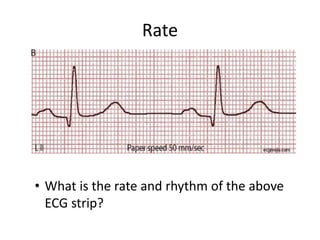 Rate
• What is the rate and rhythm of the above
ECG strip?
 