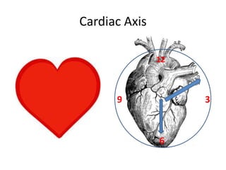 Cardiac Axis
39
12
6
 