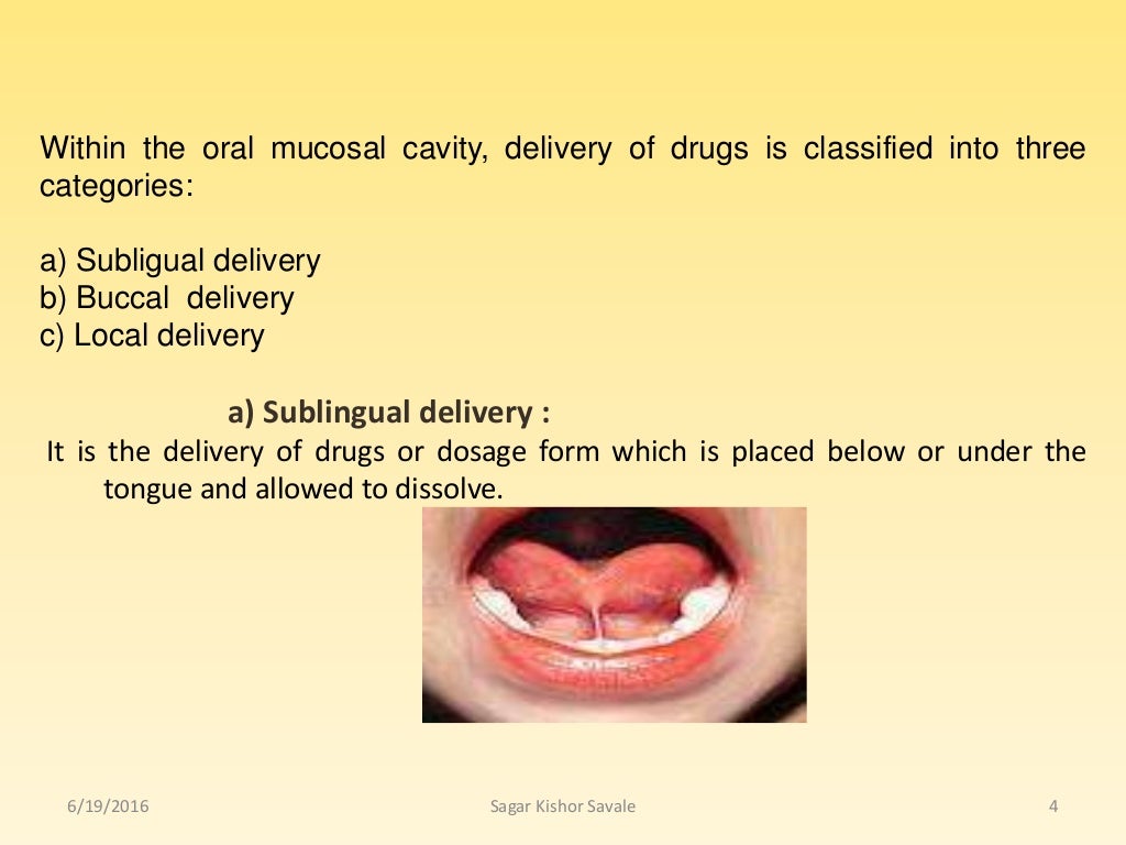 Buccal and sublingual drug delivery system