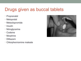 Buccal bioadhesive drug delivery system G1ppt | PPT