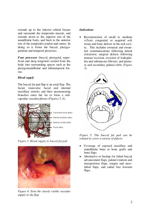 buccal fat pad axial flap