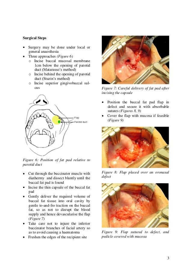 Buccal Fat pad Axial flap