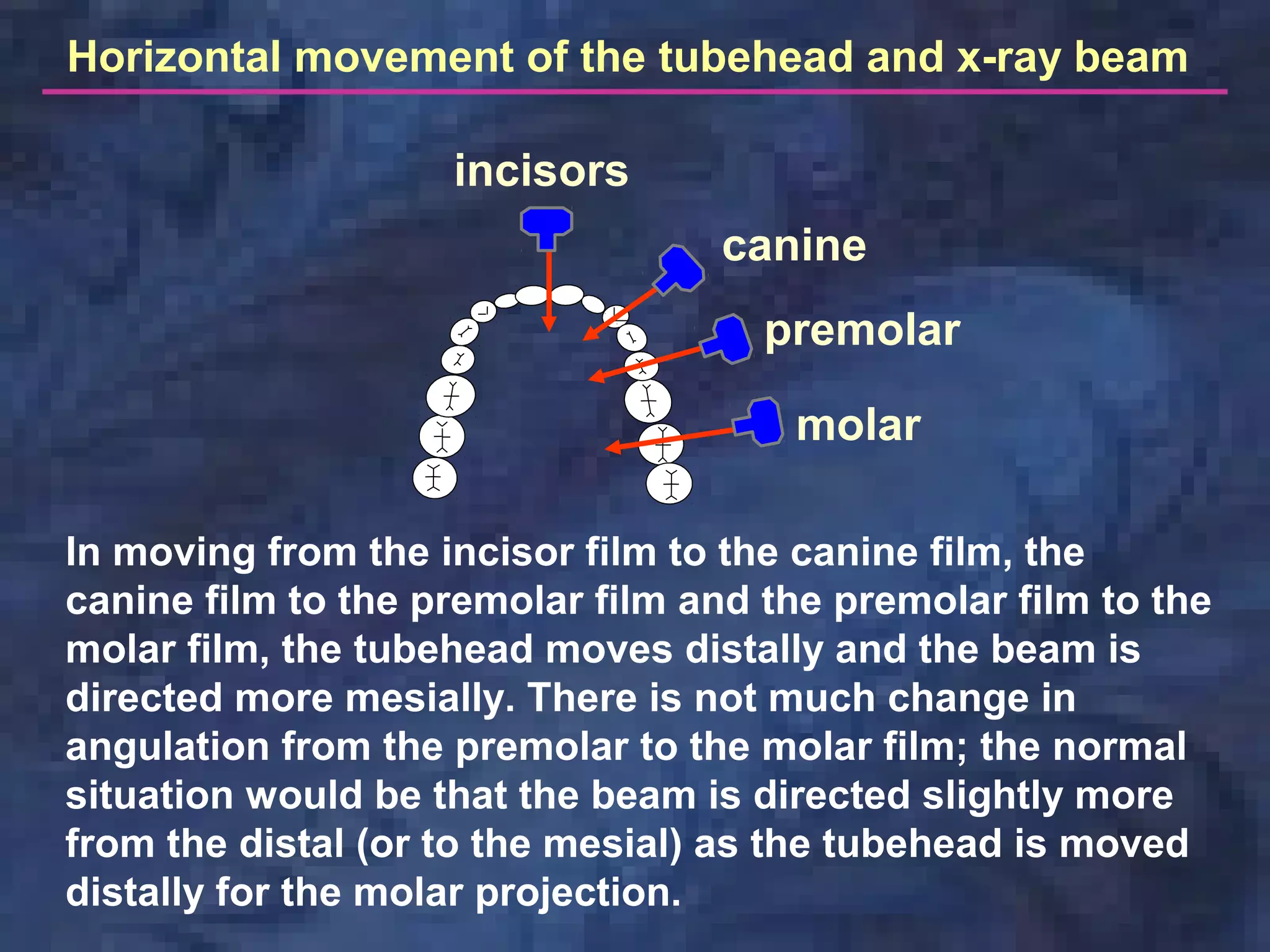 incisors
canine
premolar
molar
Horizontal movement of the tubehead and x-ray beam
In moving from the incisor film to the canine film, the
canine film to the premolar film and the premolar film to the
molar film, the tubehead moves distally and the beam is
directed more mesially. There is not much change in
angulation from the premolar to the molar film; the normal
situation would be that the beam is directed slightly more
from the distal (or to the mesial) as the tubehead is moved
distally for the molar projection.
 