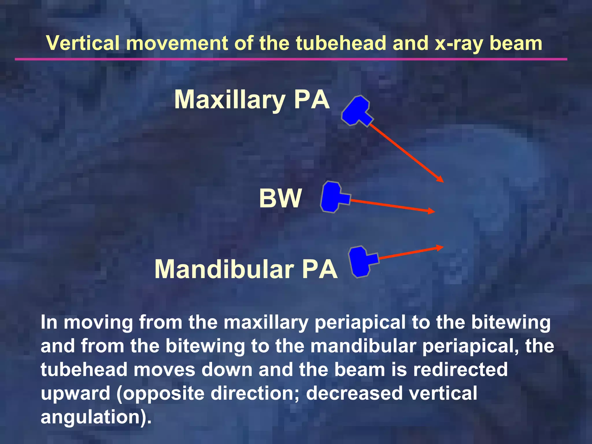 Maxillary PA
BW
Mandibular PA
Vertical movement of the tubehead and x-ray beam
In moving from the maxillary periapical to the bitewing
and from the bitewing to the mandibular periapical, the
tubehead moves down and the beam is redirected
upward (opposite direction; decreased vertical
angulation).
 