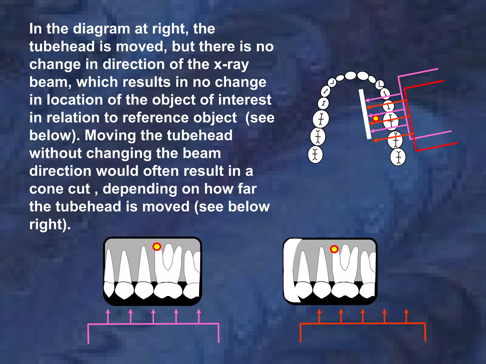 In the diagram at right, the
tubehead is moved, but there is no
change in direction of the x-ray
beam, which results in no change
in location of the object of interest
in relation to reference object (see
below). Moving the tubehead
without changing the beam
direction would often result in a
cone cut , depending on how far
the tubehead is moved (see below
right).
 