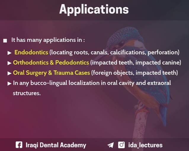 Buccal Object Rule A Radiographic Aid in Dental Practice. PPT