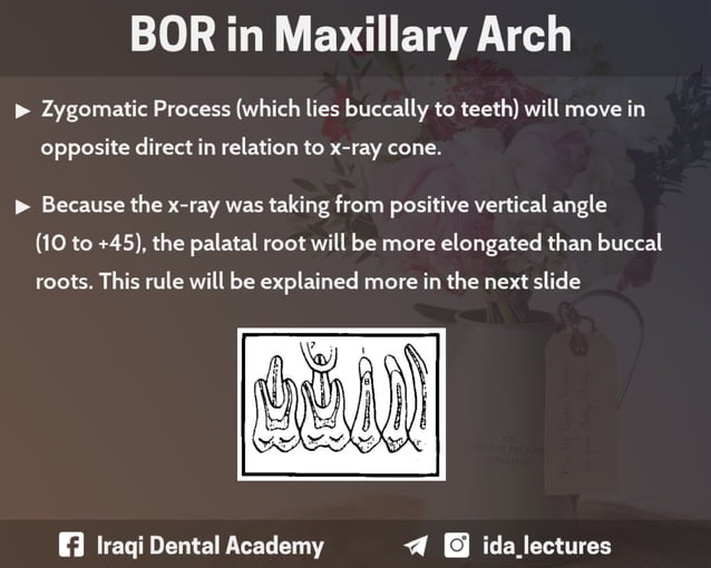 Buccal Object Rule A Radiographic Aid in Dental Practice.