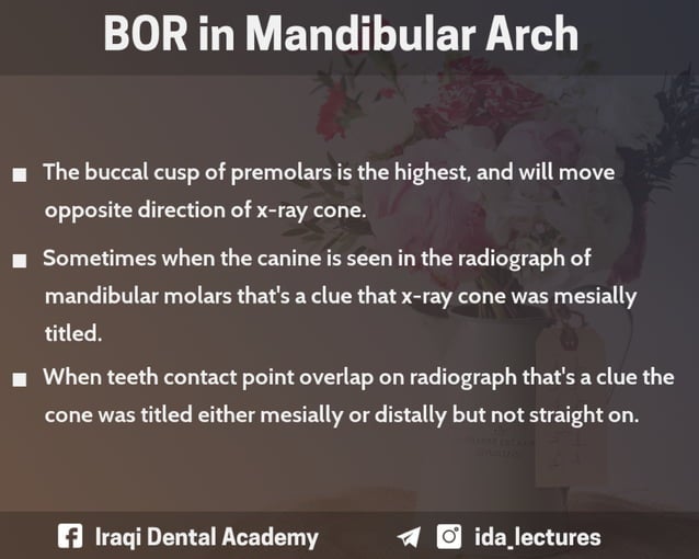Buccal Object Rule A Radiographic Aid in Dental Practice.