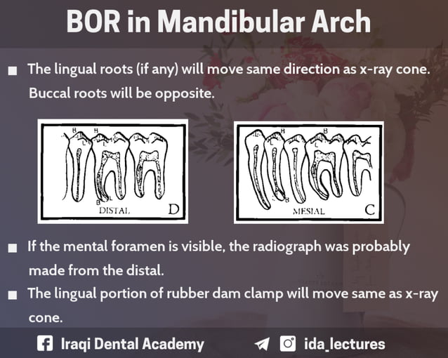 Buccal Object Rule A Radiographic Aid in Dental Practice.