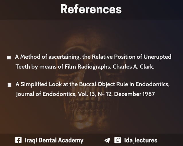 Buccal Object Rule A Radiographic Aid in Dental Practice.