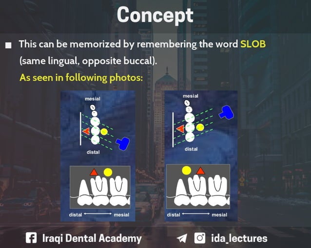 Buccal Object Rule A Radiographic Aid in Dental Practice.