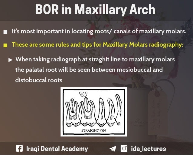Buccal Object Rule A Radiographic Aid in Dental Practice.