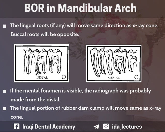 Buccal Object Rule A Radiographic Aid in Dental Practice.
