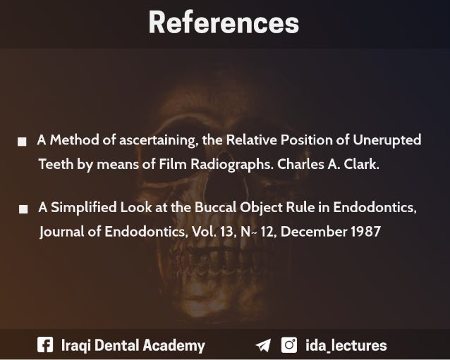 Buccal Object Rule A Radiographic Aid in Dental Practice.