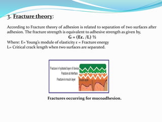 3. Fracture theory:
According to Fracture theory of adhesion is related to separation of two surfaces after
adhesion. The fracture strength is equivalent to adhesive strength as given by,
G = (Eε. /L) ½
Where: E= Young’s module of elasticity ε = Fracture energy
L= Critical crack length when two surfaces are separated.
Fractures occurring for mucoadhesion.
 