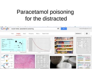 Paracetamol poisoning
for the distracted

 