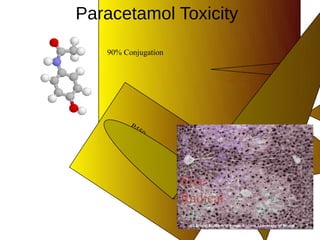 Paracetamol Toxicity
90% Conjugation

P4
50

Glutathione
NAPQI

Free
Radical

 