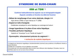 SYNDROME DE BUDD-CHIARI
IRM et TDM 1)
Confirme habituellement les aspects vus en échographie-doppler
Aspects variables en fonction du délai de l'examen
 
- Défaut de remplissage d'une veine obstruée, élargie +++ 
Hypo-dense (TDM) ou hypo-intense en T1 (IRM) 
- Aspect en toile d'araignée  
Collatérales remplaçant la veine hépatique au voisinage de l'ostium
- Image hyperdense à la place d'une veine hépatique 
- Troubles perfusion hépatique  
Aspects en "mosaïque" ou en "feuille de fougère" 2)
 
- Dysmorphie, rehaussement précoce du segment I 3)
+ recherche de nodules hépatiques
..................................................................................................................
1) Imagerie par résonance magnétique; tomodensitométrie (scanner) avec prudence si insuffisance rénale ou
ascite réfractaire.
2) Reflet de la congestion et de la dilatation sinusoïdale. 
3) Se draine par une veine particulière dans la veine cave inférieure rétro-hépatique. Évocateur mais non
spécifique (peut se voir au cours d'une cirrhose)
Claude EUGÈNE 13
 