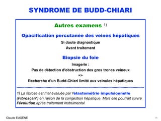 SYNDROME DE BUDD-CHIARI
Autres examens 1)
Opacification percutanée des veines hépatiques
Si doute diagnostique 
Avant traitement
Biopsie du foie
Imagerie : 
Pas de détection d'obstruction des gros troncs veineux
=>
Recherche d'un Budd-Chiari limité aux veinules hépatiques
..................................................................................................................
1) La fibrose est mal évaluée par l'élastométrie impulsionnelle
(Fibroscan*) en raison de la congestion hépatique. Mais elle pourrait suivre
l'évolution après traitement instrumental.
Claude EUGÈNE 14
 