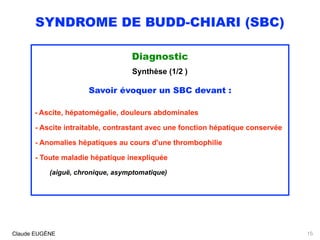 SYNDROME DE BUDD-CHIARI (SBC)
Diagnostic
Synthèse (1/2 )
Savoir évoquer un SBC devant :
- Ascite, hépatomégalie, douleurs abdominales 
- Ascite intraitable, contrastant avec une fonction hépatique conservée 
- Anomalies hépatiques au cours d'une thrombophilie
- Toute maladie hépatique inexpliquée  
(aiguë, chronique, asymptomatique)
Claude EUGÈNE 15
 