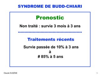 SYNDROME DE BUDD-CHIARI
Pronostic
Non traité : survie 3 mois à 3 ans
................................................
Traitements récents
Survie passée de 10% à 3 ans
à
# 85% à 5 ans
Claude EUGÈNE 19
 