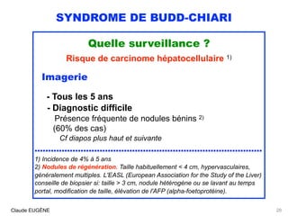 SYNDROME DE BUDD-CHIARI
Quelle surveillance ?
Risque de carcinome hépatocellulaire 1)
Imagerie
- Tous les 5 ans 
- Diagnostic difficile 
Présence fréquente de nodules bénins 2) 
(60% des cas)
Cf diapos plus haut et suivante
....................................................................................
1) Incidence de 4% à 5 ans
2) Nodules de régénération. Taille habituellement < 4 cm, hypervasculaires,
généralement multiples. L'EASL (European Association for the Study of the Liver)
conseille de biopsier si: taille > 3 cm, nodule hétérogène ou se lavant au temps
portal, modification de taille, élévation de l'AFP (alpha-foetoprotéine).
Claude EUGÈNE 28
 
