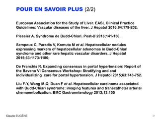 POUR EN SAVOIR PLUS (2/2)
European Association for the Study of Liver. EASL Clinical Practice
Guidelines: Vascular diseases of the liver. J Hepatol 2016;64:179-202.
Plessier A. Syndrome de Budd-Chiari. Post-U 2016;141-150.
Sempoux C, Paradis V, Komuta M et al. Hepatocellular nodules
expressing markers of hepatocellular adenomas in Budd-Chiari
syndrome and other rare hepatic vascular disorders. J Hepatol
2015;63:1173-1180;
De Franchis R. Expanding consensus in portal hypertension: Report of
the Baveno VI Consensus Workshop: Stratifying and and
individualizing care for portal hypertension. J Hepatol 2015;63:743-752.
Liu F-Y, Wang M-Q, Duan F et al. Hepatocellular carcinoma associated
with Budd-Chiari syndrome: imaging features and transcatheter arterial
chemoembolization. BMC Gastroenterology 2013;13:105
Claude EUGÈNE 31
 