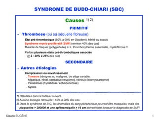 SYNDROME DE BUDD-CHIARI (SBC)
Causes 1) 2)
PRIMITIF
- Thrombose (ou sa séquelle fibreuse) 
État pré-thrombotique (80% à 90% en Occident), hérité ou acquis 
Syndrome myelo-prolifératif (SMP) (environ 40% des cas) 
Maladie de Vaquez (polyglobulie) +++, thrombocythémie essentielle, myélofibrose 3)
 
Parfois plusieurs états pré-thrombotiques associés 
(> 2 : 20% à 25% des cas)
SECONDAIRE
- Autres étiologies 
Compression ou envahissement 
. Tumeurs bénignes ou malignes, de siège variable:  
hépatique, rénal, cardiaque (myxome), veineux (leiomyosarcome)
. Parasitoses (hydatidose, échinococcose) 
. Kystes
............................................................................................................................
1) Détaillées dans le tableau suivant.  
2) Aucune étiologie retrouvée : 10% à 20% des cas.
3) Dans le syndrome de B-C, les anomalies du sang périphérique peuvent être masquées; mais des
plaquettes > 200000 et une splénomégalie > 16 cm doivent faire évoquer le diagnostic de SMP.
Claude EUGÈNE 5
 