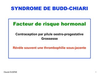 SYNDROME DE BUDD-CHIARI
Facteur de risque hormonal
Contraception par pilule oestro-progestative
Grossesse
Révèle souvent une thrombophilie sous-jacente
Claude EUGÈNE 8
 