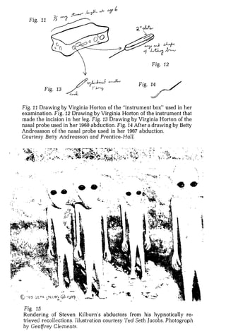 Fig. 1 1

                                                 �··�




                            --��7!:                     Fig. 1 2



                                                  Fig. 1 4

                                                       .�
                                                             J
Fig. 1 1 Drawing by Virginia Horton of the "instrument box" used in her
examination. Fig. 12 Drawing by Virginia Horton of the instrument that
made the incision in her leg. Fig. 1 3 Drawing by Virginia Horton of the
nasal probe used in her 1960 abduction. Fig. 1 4 After a drawing by Betty
Andreasson of the n asal probe used in her 1967 abduction.
Co urtesy Betty Andreasson and P re n t ic e Hall .
                                          -




                                                                    ;
                                                                   i




                                                                        • •
              '. .




Fig. 1 5
Rendering o f Steven Kilburn's abductors from his hypnotically re­
trieved recollections. Illustration courtesy Ted Seth Jacobs. Photograph
by Geoffrey Clements.
 