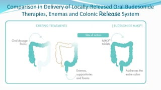 Comparison in Delivery of Locally-Released Oral Budesonide
Therapies, Enemas and Colonic Release System
 