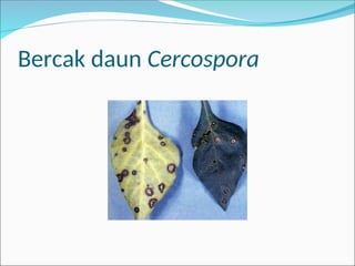 Bercak daun Cercospora
 
