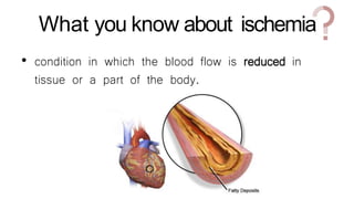 What you know about ischemia
• condition in which the blood flow is reduced in
tissue or a part of the body.
 