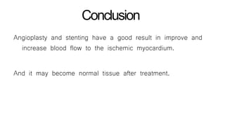Conclusion
Angioplasty and stenting have a good result in improve and
increase blood flow to the ischemic myocardium.
And it may become normal tissue after treatment.
 