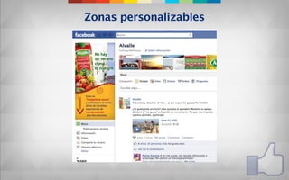 Zonas personalizables
 
