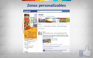 Zonas personalizables
 