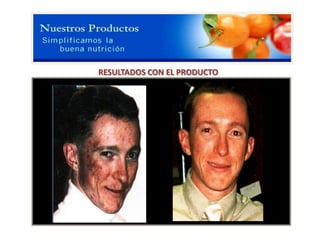 RESULTADOS CON EL PRODUCTO


                  HERBALIFE LINE

                 Ácidos grasos omega 3
            Ayudan a mejorar la elasticidad de
            Las arterias mejora la circulación,
           Presión alta, triglicéridos, colesterol,
                             Etc.

             Tomar una cápsula 3 veces al día
                   1 - 1         - 1
 