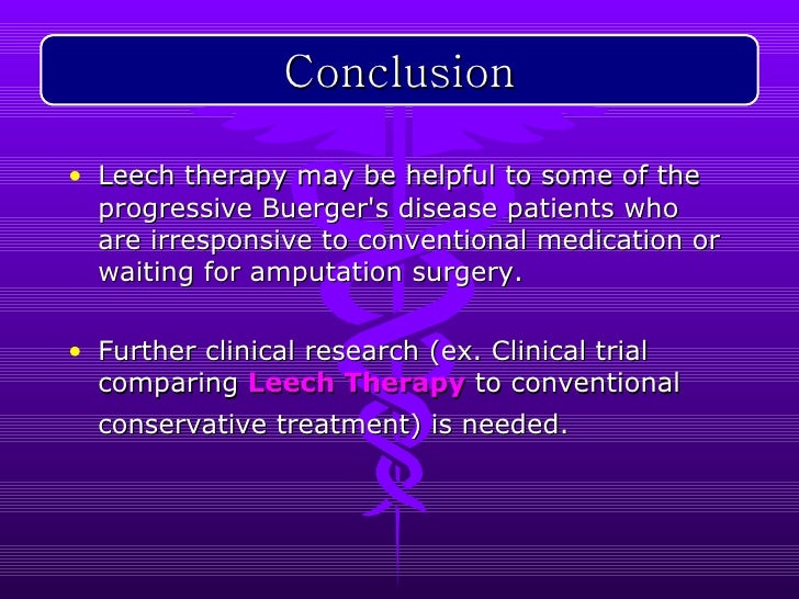 Buergers Disease Leech Therapy
