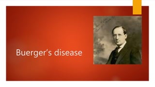 Buerger’s disease
 