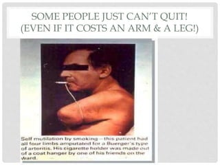 SOME PEOPLE JUST CAN’T QUIT!
(EVEN IF IT COSTS AN ARM & A LEG!)
 